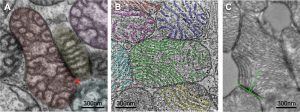 Mitochondria microscopy