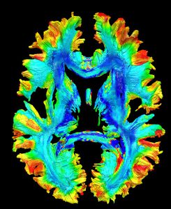 Heat map of the distribution of mitochondria in the brain, showing more mitochondria toward the outside of the brain