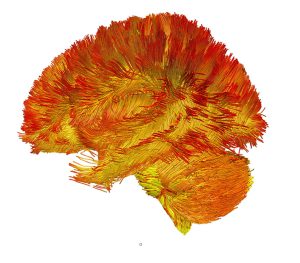 Read and yellow heat map of the distribution of mitochondria in the brain, showing more mitochondria toward the outside of the brain